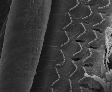 Electron Microscopy Cell 的图像结果