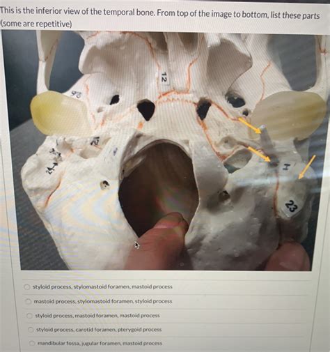 Image result for Styloid Process of Temporal Bone Inferior View
