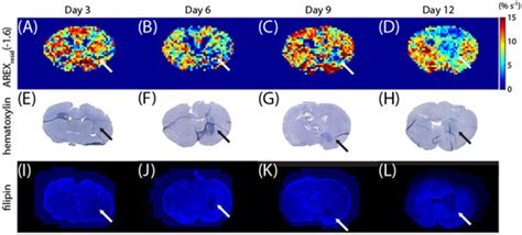 Chemical Exchange Saturation Transfer (CEST) Signal at −1.6 ppm and Its ...