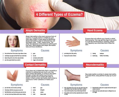 Eczema - Dualight – High Quality Light Therapy