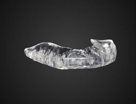 Occlusal Appliances – Frontier Dental Laboratories
