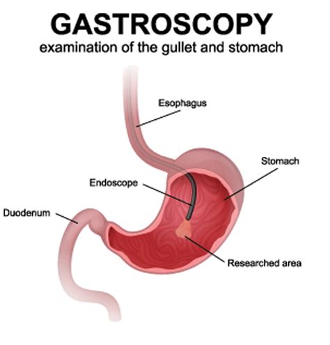 INTERNATIONAL MEDICARE SERVICES | Gastroenterology