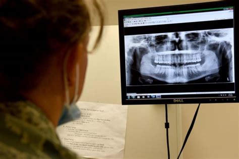 Image result for FEDVIP Vision Insurance