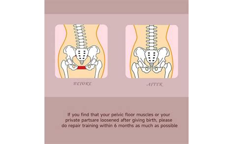 B-Arm Pelvic Floor Muscle Trainer with Screw - Pink | Targeted Leg ...