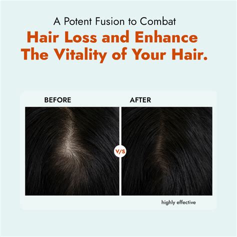 Matte Finish SPF 50+ Sunscreen Gel | Water Resistant | PA++++ – ALZIBA ...