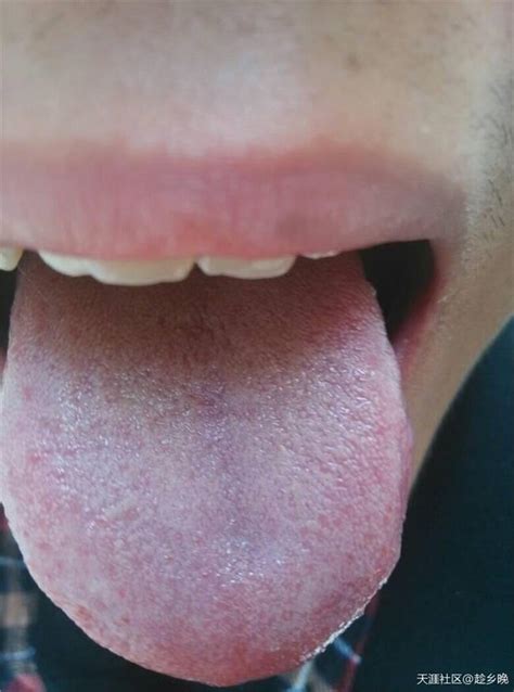 正常舌苔什么颜色 中医讲的舌苔的正常颜色应是什么_第二人生