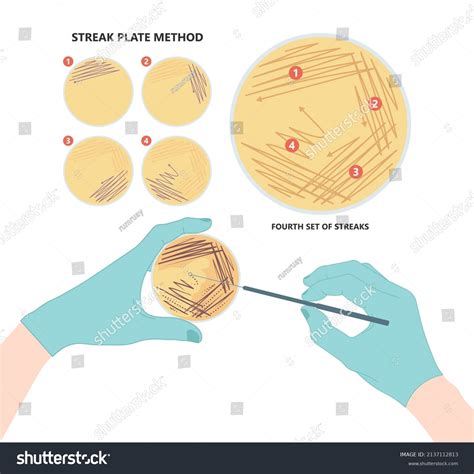 Microbiology Agar Streak Plate at Harry Cairns blog