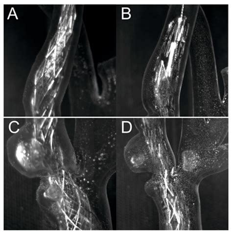 Three-Dimensionally Printed Elastic Cardiovascular Phantoms for Carotid ...