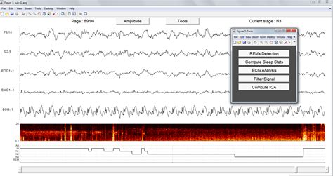 EEG MATLAB Load File 的图像结果