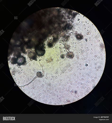 Fungi Under A Microscope