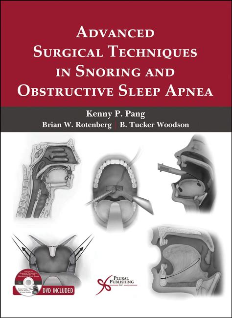 Advanced Surgical Techniques in Snoring and Obstructive Sleep Apnea – Surgery Books
