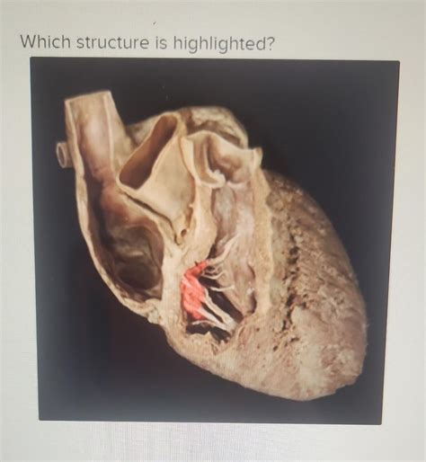 Solved Which structure is highlighted? | Chegg.com
