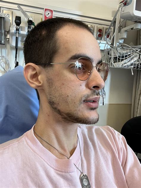 maxillary downgraft : r/jawsurgery