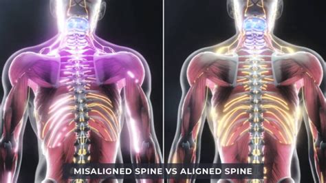 Image result for Chiropractic String Frame Alignment-Frame