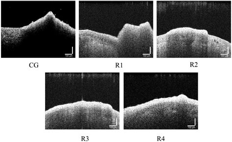 Effect of In Situ Aeration on Ultrafiltration Membrane Fouling Control ...