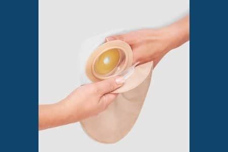 Image result for Pouchoscopy Prep