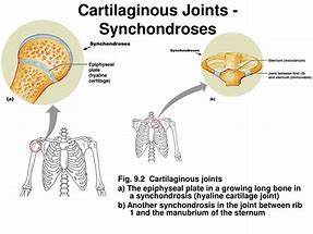 Image result for cartilaginous