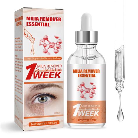 Milia Remover Milia Spot Treatment Helps Dissolve And Reduce Milia ...