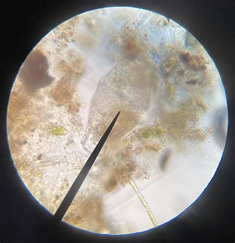 You may not care but I love looking at pond water under a microscope (a ...