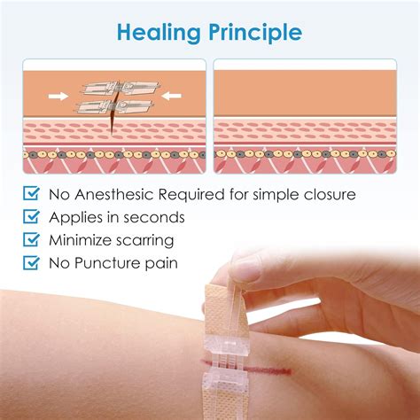 Buy SEABIRD Emergency Wound Closure Device, Zip Wound Closure Strips ...