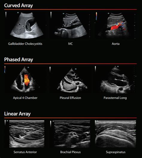 Image result for Mindray Te7 Measurements Tutorial