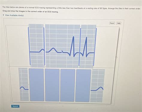 Solved: The tiles below are pieces of a normal ECG tracing representing ...