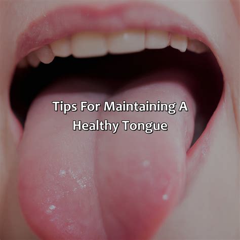 What Is A Healthy Tongue Color at Lilly Manning blog
