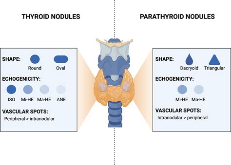 Parathyroid Nodules