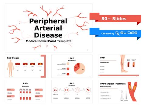 Download Peripheral Arterial Disease PowerPoint Template|RxSlides