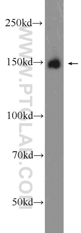 CPS1 antibody (24513-1-AP) | Proteintech