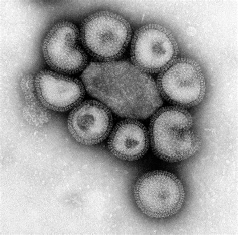 Free picture: flu, contagious, respiratory, illness, influenza, viruses