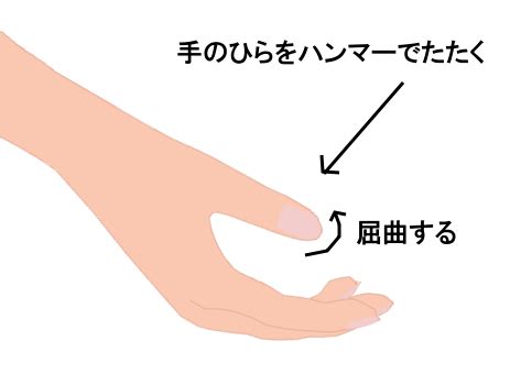 ワルテンベルグ反射とワルテンベルグサイン - 伊藤内科医院