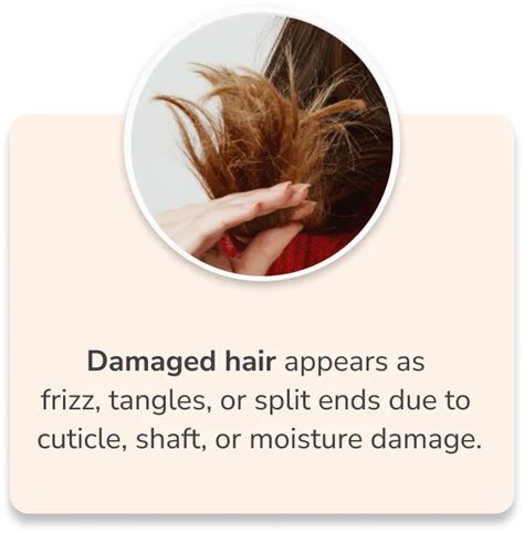 Hair Loss Treatment for Women - Holistic Hair fall Solutions for ...
