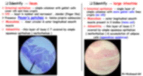 Image result for Duodenum vs Jejunum
