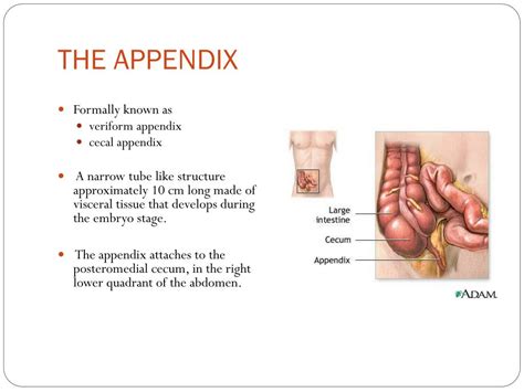 Image result for Appendicitis