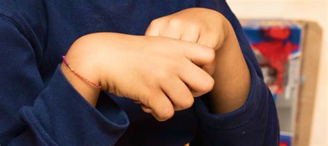 Image result for Alien Hand Syndrome Documentary