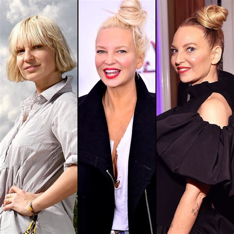 Sia Has Gotten Candid About Her Facelift and Liposuction: Plastic Surgery Before and After Photos