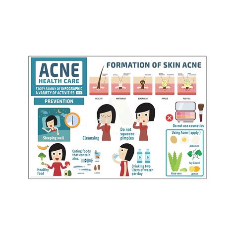Anne Print Solutions® Formation of skin acne chart Posters For Hospital ...