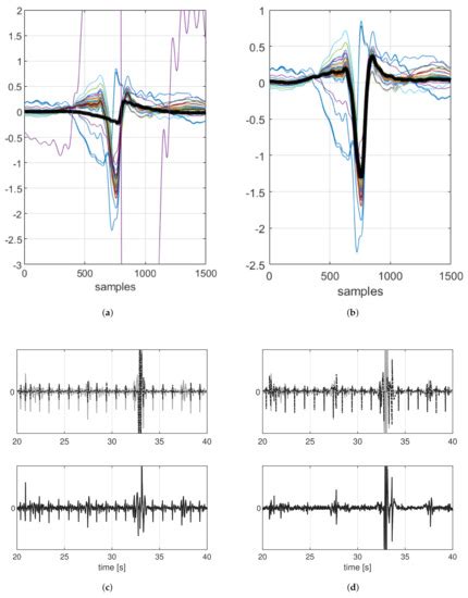 Sensors | Special Issue : Sensors and Biomedical Signal Processing for ...