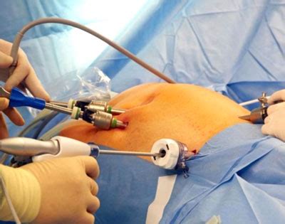 Best Gynecologist & Surgeon, Thane - Dr. Anshika Kashyap