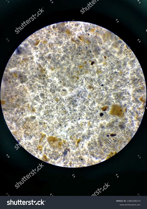 Entamoeba Histolytica Life Cycle Animation