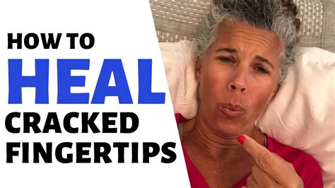 How to *HEAL* Cracked Fingertips | Stop Your Fingertips from Cracking ...
