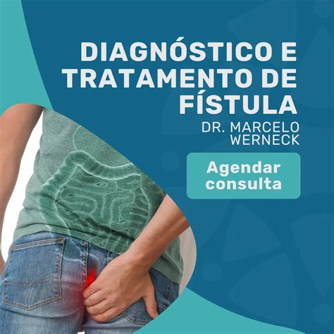Como saber se tenho fístula perianal? Sintomas e diagnóstico