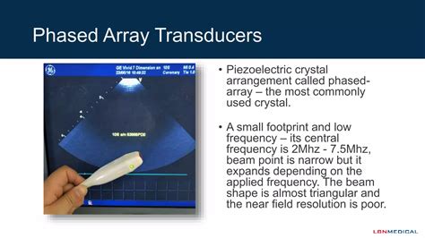 Image result for Ultrasonic Transducer Types