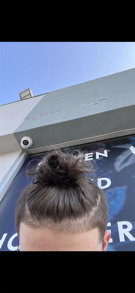 Is my hairline as messed up as I think or am I buggin ? : r/malehairadvice