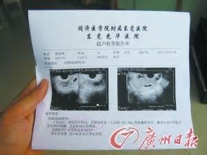 胎儿初检被指“死胎” 换医院检查后复活(图)_新闻_腾讯网