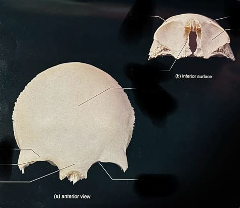 Frontal bone Landmarks Diagram | Quizlet