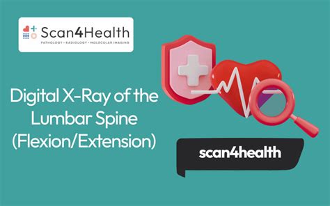 Digital X-Ray of the Lumbar Spine (Flexion/Extension) - Scan4Health ...