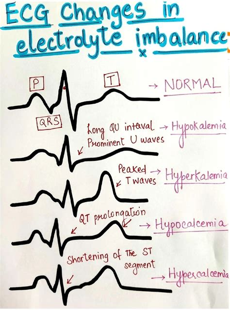 ECG Changes in Electrolyte Imbalance | Visual Guide for Medical Students