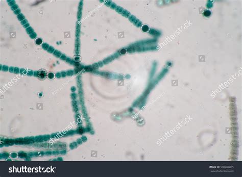 Anabaena Under Microscope Labeled